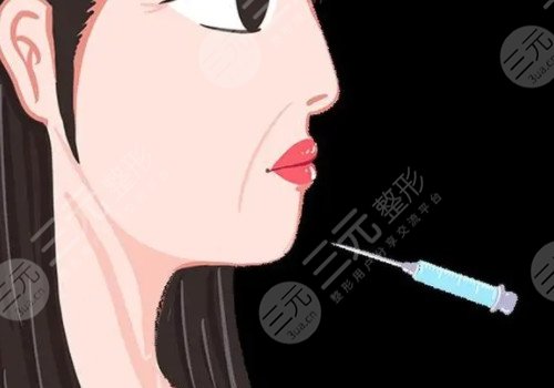 正規(guī)醫(yī)院注射除皺價格是多少？