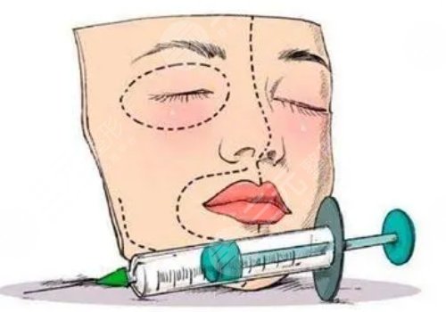 改良臉部輪廓做什么整形手術(shù)好？