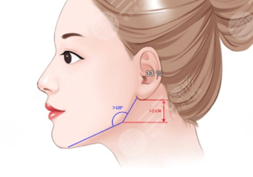 籍建華磨骨怎么樣?