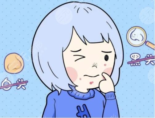 去黑頭有效的方法有哪些起效快速？5個好用的方法，一周一次