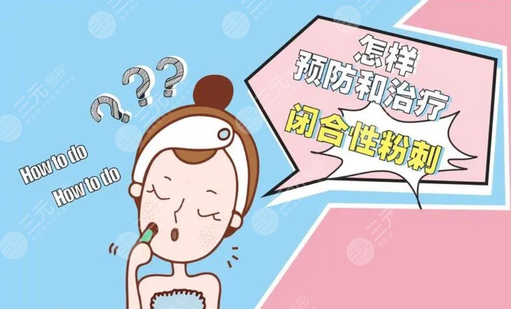 閉合性粉刺怎么徹底去除