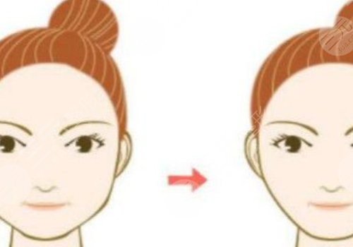 籍建華醫(yī)生擅長項目科普