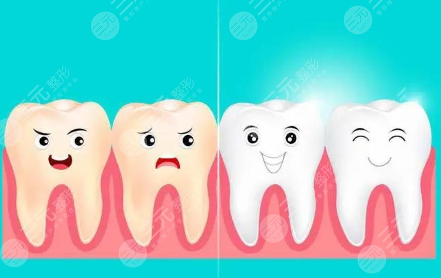 冷光美白牙齒的注意事項(xiàng)