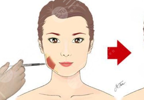 臉部微調(diào)大概多少錢？包括哪些項目？