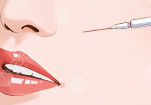 臉部微調(diào)大概多少錢？包括哪些項目？