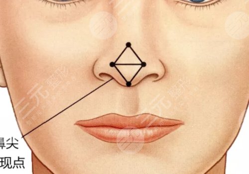 安徽維多利亞整形醫(yī)院怎么樣？