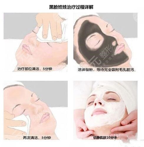 黑臉娃娃可以維持多久?