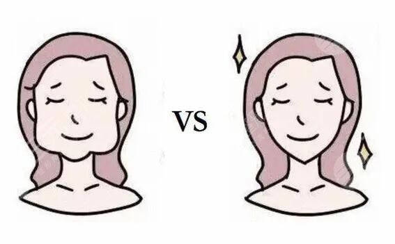 下頜角接骨整形技術(shù)的注意事項