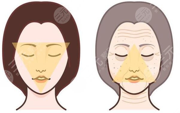 注射除皺安全嗎?