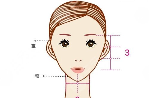 輪廓手術(shù)過(guò)程圖片|網(wǎng)友恢復(fù)案例