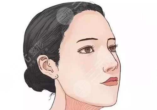 輪廓手術(shù)過(guò)程圖片|網(wǎng)友恢復(fù)案例