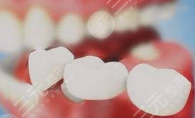 如何美白牙齒安全不傷牙？與大黃牙說byebye