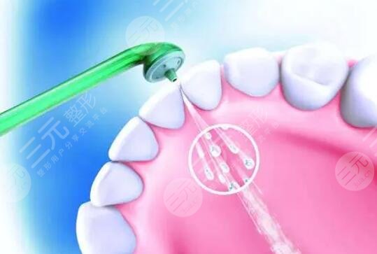 定期維持口腔健康