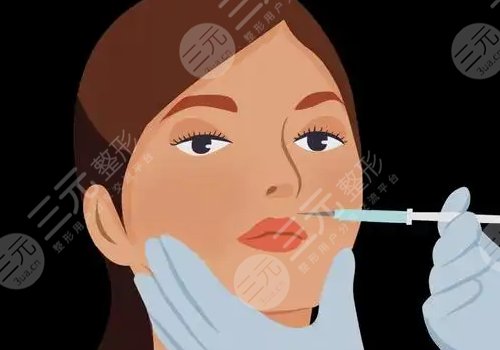 面部輪廓針是什么？