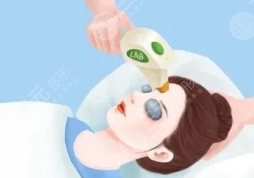 微調(diào)整形都有什么項目？