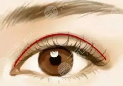 北京清木醫(yī)療美容醫(yī)院正規(guī)嗎？