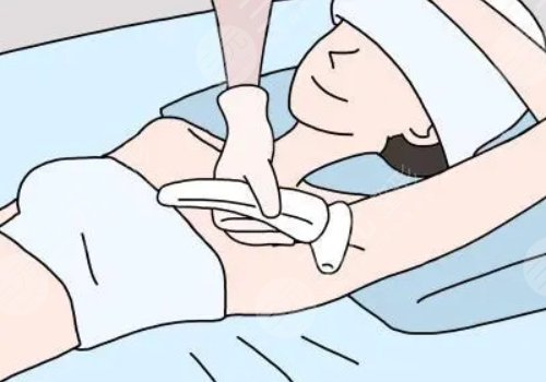 激光脫毛和冰點脫毛哪個好？