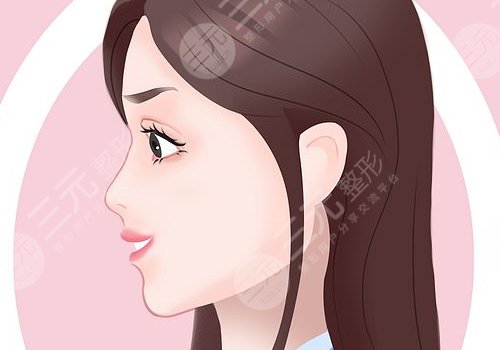 打玻尿酸隆鼻子有副作用嗎？