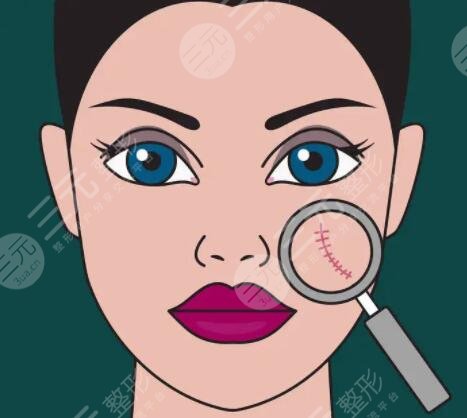 點痣后留下的疤痕多久恢復(fù)自然？有效的祛疤/預(yù)防疤痕的措施