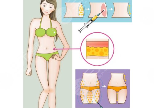 西安國際醫(yī)學(xué)中心醫(yī)院整形科怎么樣？