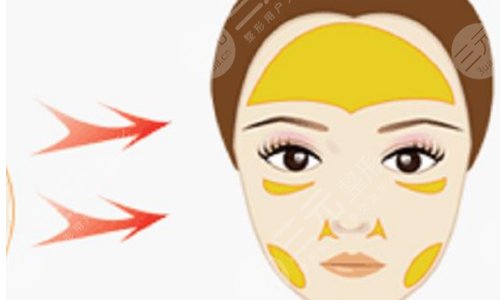 西安國際醫(yī)學(xué)中心醫(yī)院整形科孫峰怎么樣？