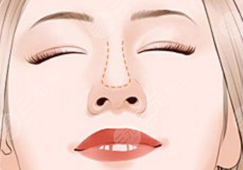 鄭州大學(xué)第二附屬醫(yī)院整形科怎么樣