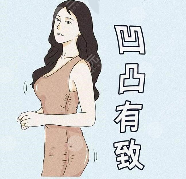 杭州時光醫(yī)療美容醫(yī)院隆胸項目科普