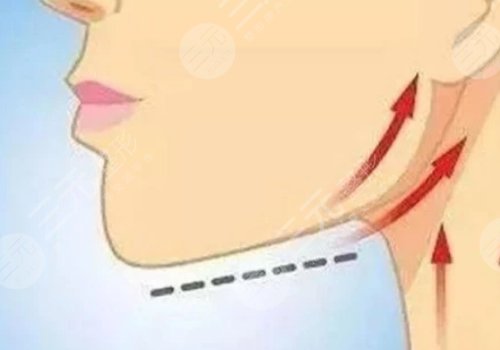 輪廓固定的危害