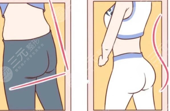 隔空溶脂多少次才能達到效果？不減肥就能瘦的項目初體驗！