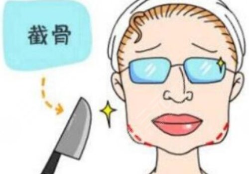 戴牙套可以做輪廓手術(shù)嗎？