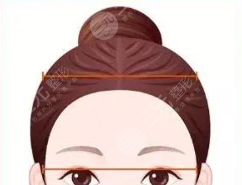 打造高顱頂動漫