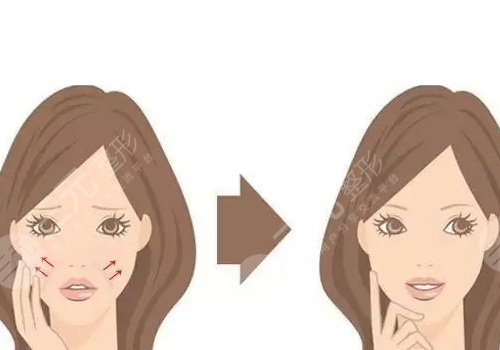 怎樣提升面部下垂？