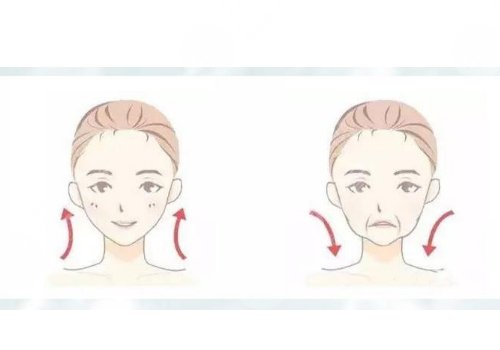 怎樣提升面部下垂？