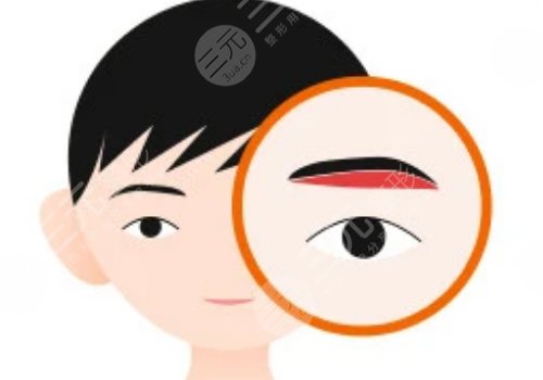 提眉的好處和壞處有什么？