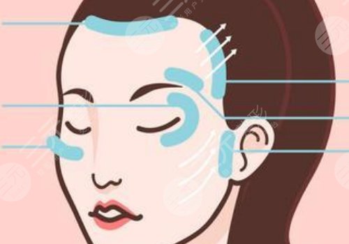 輪廓提升多久有效果？