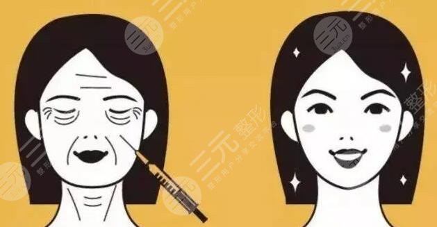 小拉皮手術(shù)是什么?