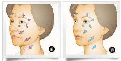 雙燕尾拉皮和小拉皮區(qū)別