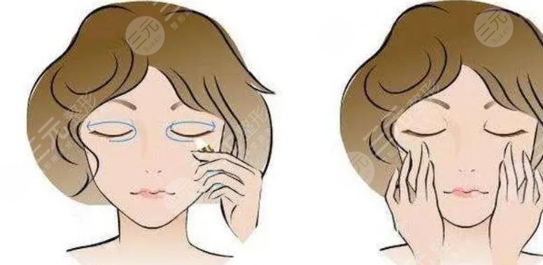 外切眼袋加眶隔釋放加填充淚溝