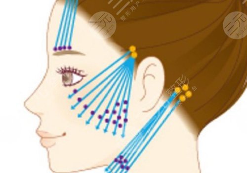 做完線雕多久可以恢復(fù)？