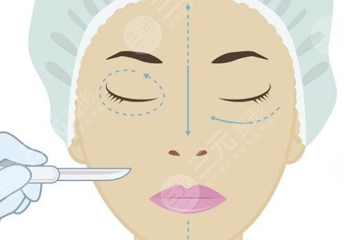 內(nèi)輪廓是指哪里部位？