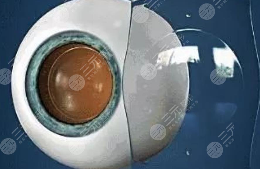 晶體植入手術(shù)的利與弊