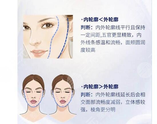 內(nèi)輪廓是指哪里部位？