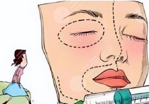 線雕臉1到7天恢復過程圖片