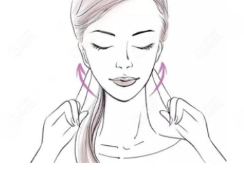 線雕臉1到7天恢復過程圖片