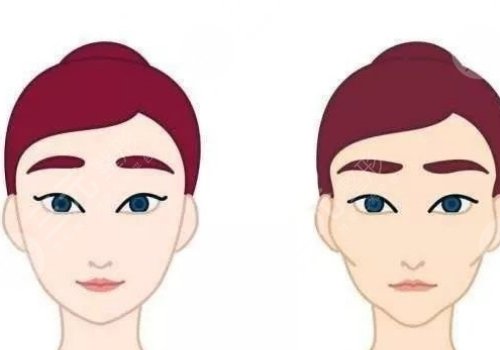 輪廓手術(shù)危險嗎？