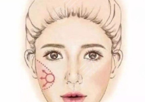 內(nèi)輪廓線和外輪廓線的區(qū)別是什么