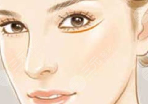 注射伊妍仕腫一個(gè)多月正常嗎？