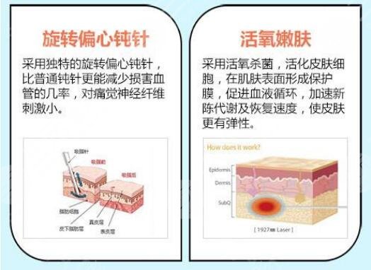 杭州腰腹部吸脂價格公布！好評醫(yī)院2家分享，避坑指南~