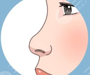 南方醫(yī)院羅勇隆鼻怎么樣