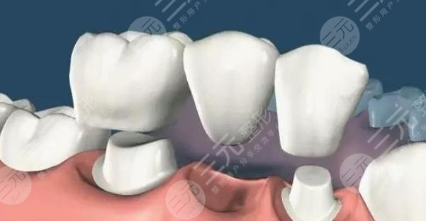 補牙封藥后疼正?常嗎?